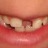 sonrisa_mellada